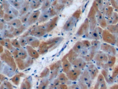 DABstainingonIHC-P.Samples:HumanTissue)