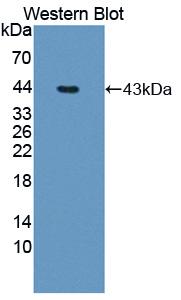 5-Methyltetrahydrofolate Homocysteine Methyltransferase (MTR) Polyclonal Antibody - image 2