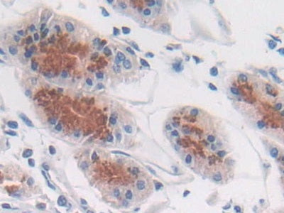 ATPase, H+ Transporting, Lysosomal Accessory Protein 2 (ATP6AP2) Polyclonal Antibody - image 4