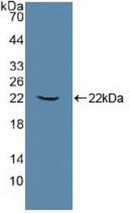 Western Blot; Sample: Human 293T cell lysate; ; Primary Ab: 5µg/ml Rabbit Anti-Human ATP1a1 Antibody; Second Ab: 0.2µg/mL HRP-Linked Caprine Anti-Rabbit IgG Polyclonal Antibody;