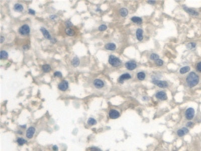 DAB staining on IHC-P; Samples: Human Stomach Tissue