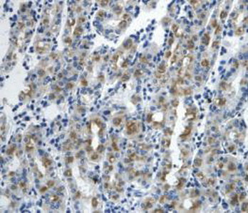 ATPase, Na+/K+ Transporting Alpha 1 Polypeptide (ATP1a1) Polyclonal Antibody - image 5