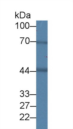 Western Blot; Sample: Recombinant protein.
