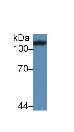 Western Blot; Sample: Recombinant protein.