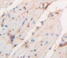 Corin (CRN) Polyclonal Antibody - image 4