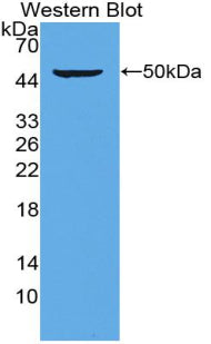 Proteasome 26S Subunit, ATPase 6 (PSMC6) Polyclonal Antibody - image 2
