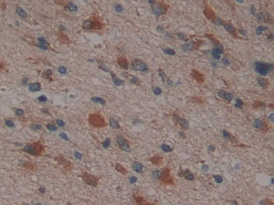 Proteasome 26S Subunit, ATPase 6 (PSMC6) Polyclonal Antibody - image 4