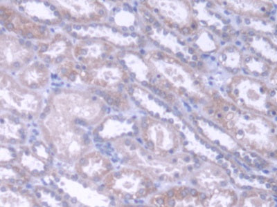 DAB staining on IHC-P; Samples: Human Kidney Tissue)