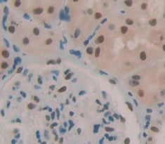 Oxidative Stress Induced Growth Inhibitor 1 (OSGIN1) Polyclonal Antibody - image 3