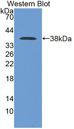 Adaptor Related Protein Complex 2 Mu 1 (AP2m1) Polyclonal Antibody - image 2