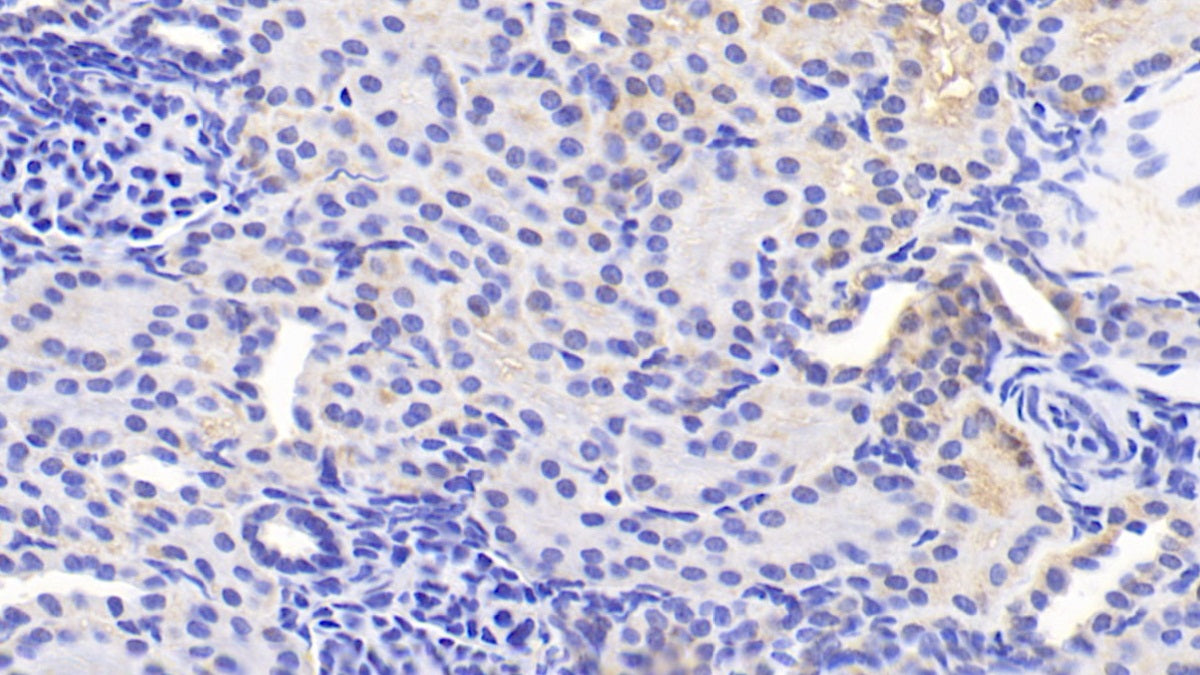Adaptor Related Protein Complex 2 Mu 1 (AP2m1) Polyclonal Antibody - image 3