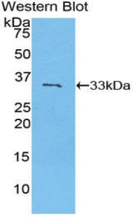 Purinergic Receptor P2Y, G Protein Coupled 14 (P2RY14) Polyclonal Antibody - image 2