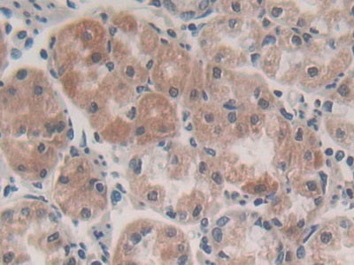 DAB staining on fromalin fixed paraffin-embedded Stomach tissue)