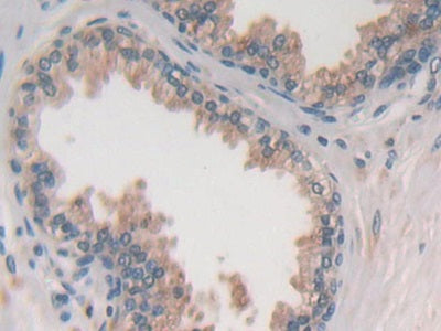 Purinergic Receptor P2Y, G Protein Coupled 14 (P2RY14) Polyclonal Antibody - image 4
