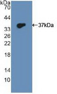 DAB staining on IHC-P; Samples: Human Prostate Tissue; Primary Ab: 20µg/ml Rabbit Anti-Human DUSP6 Antibody Second Ab: 2µg/mL HRP-Linked Caprine Anti-Rabbit IgG Polyclonal Antibody
