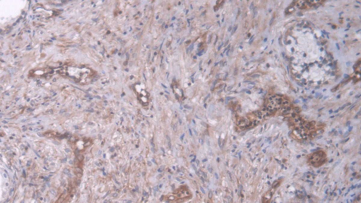 DAB staining on IHC-P. Samples: Human Tissue)