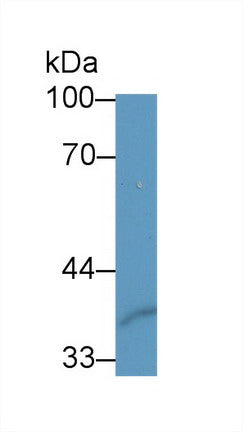 Western Blot; Sample: Recombinant protein.