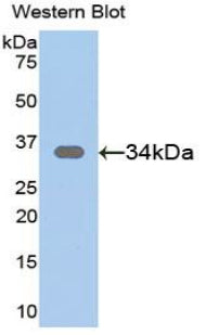 DAB staining on IHC-P; Samples: Mouse Testis Tissue; Primary Ab: 20μg/ml Rabbit Anti-Mouse SFRP1 Antibody Second Ab: 2µg/mL HRP-Linked Caprine Anti-Rabbit IgG Polyclonal Antibody