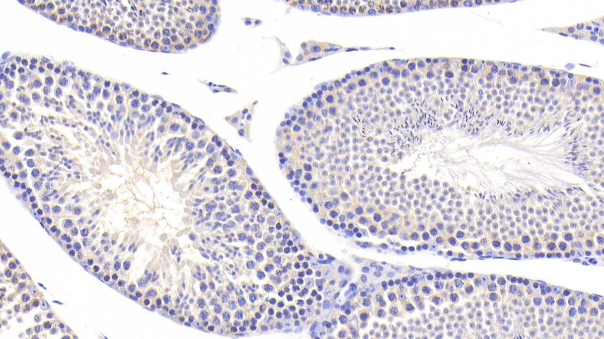 DAB staining on fromalin fixed paraffin-embedded Kidney tissue)