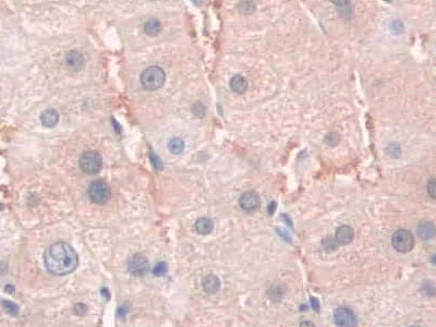 DAB staining on IHC-P; Samples: Human Liver Tissue