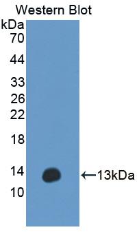 Western Blot; Sample: Porcine Liver lysate; ; Primary Ab: 1µg/ml Rabbit Anti-Human ANO6 Antibody; Second Ab: 0.2µg/mL HRP-Linked Caprine Anti-Rabbit IgG Polyclonal Antibody;
