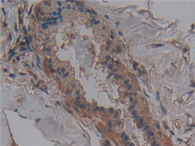 DABstainingonIHC-P.Samples:HumanTissue)