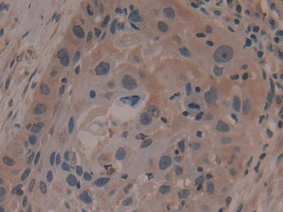Anoctamin 6 (ANO6) Polyclonal Antibody - image 5