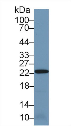 Western Blot; Sample: Recombinant protein.