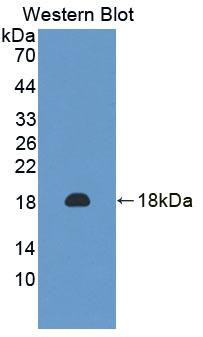 DAB staining on IHC-P; Samples: Human Liver Tissue;  Primary Ab: 10µg/ml Rabbit Anti-Human PRDX2 Ant