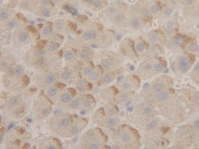 Peroxiredoxin 2 (PRDX2) Polyclonal Antibody - image 4
