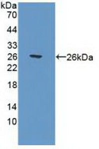 DAB staining on IHC-P; Samples: Human Spleen Tissue;  Primary Ab: 20μg/ml Rabbit Anti-Human POLg1 Antibody Second Ab: 2µg/mL HRP-Linked Caprine Anti-Rabbit IgG Polyclonal Antibody