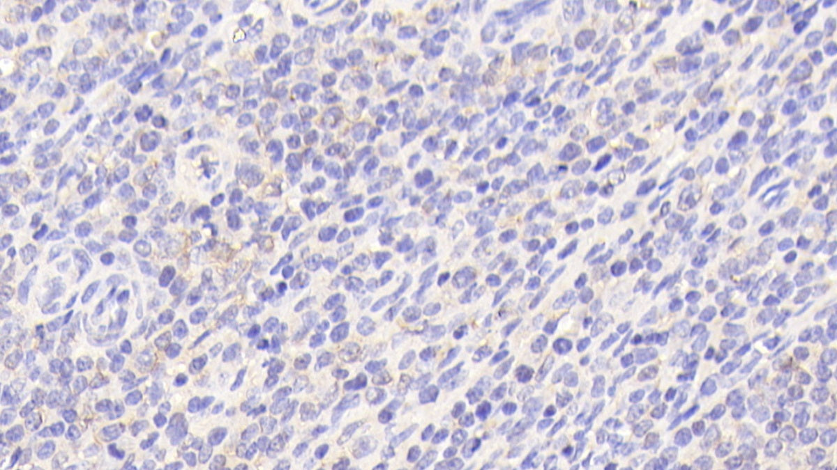 Polymerase DNA Directed Gamma 1 (POLg1) Polyclonal Antibody - image 4