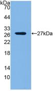 DAB staining on IHC-P; Samples: Mouse Cardiac Muscle Tissue;  Primary Ab: 20μg/ml Rabbit Anti-Mouse LOXL1 Antibody Second Ab: 2µg/mL HRP-Linked Caprine Anti-Rabbit IgG Polyclonal Antibody