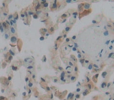 Lysyl Oxidase Like Protein 1 (LOXL1) Polyclonal Antibody - image 3