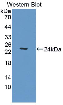 Carnosine Dipeptidase 1 (CNDP1) Polyclonal Antibody - image 2