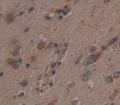 Carnosine Dipeptidase 1 (CNDP1) Polyclonal Antibody - image 3