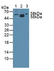Knockout Varification: <br/>Lane 1: Wild-type PC3 cell lysate; <br/>Lane 2: ANTXR2 knockout PC3 cell lysate; <br/>Predicted MW: 54,53,43,35kd <br/>Observed MW: 58kd<br/>Primary Ab: 1µg/ml Rabbit Anti-Human ANTXR2 Antibody<br/>Second Ab: 0.2µg/mL HRP-Linked Caprine Anti-Rabbit IgG Polyclonal Antibody<br/>
