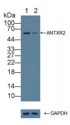 DAB staining on IHC-P; Samples: Human Kidney Tissue; Primary Ab: 20µg/ml Rabbit Anti-Human ANTXR2 Antibody Second Ab: 2µg/mL HRP-Linked Caprine Anti-Rabbit IgG Polyclonal Antibody
