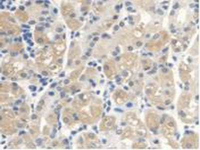 Anthrax Toxin Receptor 2 (ANTXR2) Polyclonal Antibody - image 5