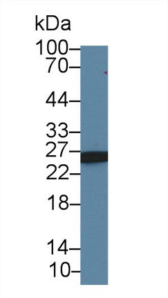 Western Blot; Sample: Recombinant protein.