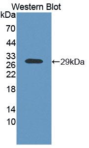 DAB staining on IHC-P; Samples: Human Cerebrum Tissue; Primary Ab: 30µg/ml Rabbit Anti-Human AK3 Antibody Second Ab: 2µg/mL HRP-Linked Caprine Anti-Rabbit IgG Polyclonal Antibody