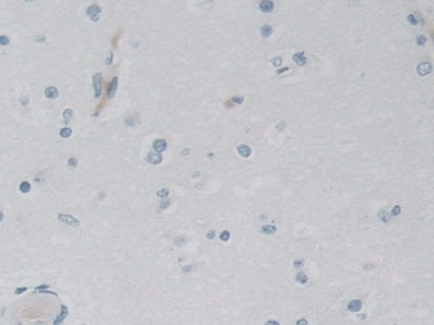 Adenylate Kinase 3 (AK3) Polyclonal Antibody - image 4