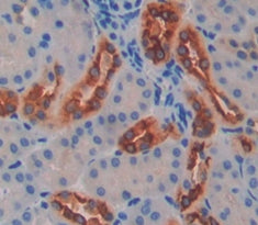 Fucosyltransferase 8 (FUT8) Polyclonal Antibody - image 3