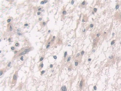 Fucosyltransferase 6 (FUT6) Polyclonal Antibody - image 4