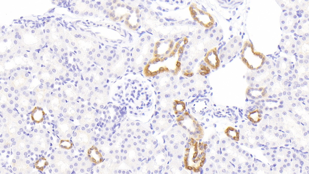 11-Beta-Hydroxysteroid Dehydrogenase Type 2 (HSD11b2) Polyclonal Antibody - image 3