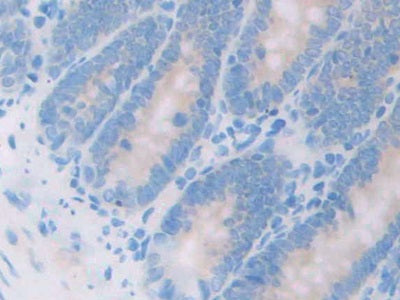 17-Beta-Hydroxysteroid Dehydrogenase Type 12 (HSD17b12) Polyclonal Antibody - image 4