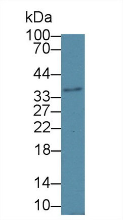 Western Blot; Sample: Recombinant protein.