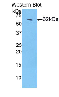 DAB staining on IHC-P; Samples: Mouse Lymph node Tissue; Primary Ab: 20µg/ml Rabbit Anti-Mouse HSD17b12 Antibody Second Ab: 2µg/mL HRP-Linked Caprine Anti-Rabbit IgG Polyclonal Antibody