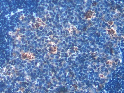 DAB staining on fromalin fixed paraffin- embedded kidney tissue)