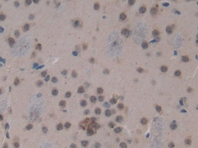 17-Beta-Hydroxysteroid Dehydrogenase Type 12 (HSD17b12) Polyclonal Antibody - image 5